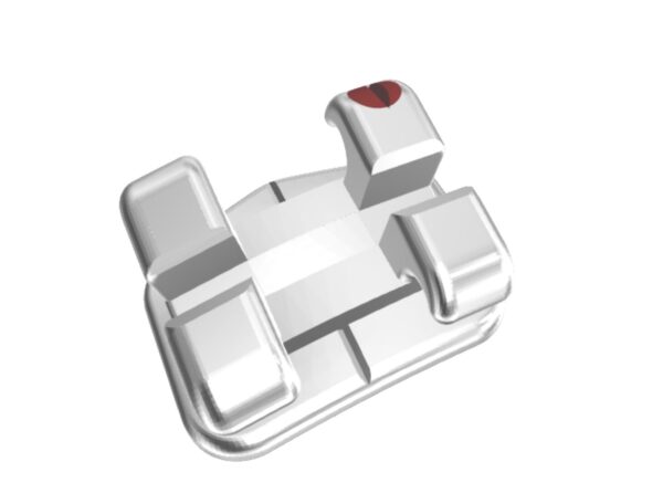 Tommy Omni Arch RC (Wires and Buccal Tubes Only) - Image 3