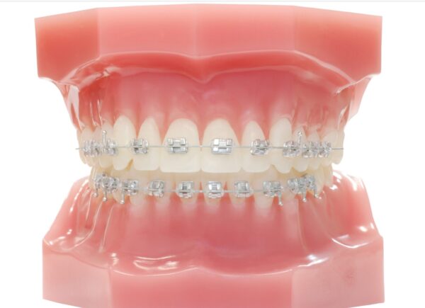 Tommy Omni Arch RC (Wires and Buccal Tubes Only) - Image 2